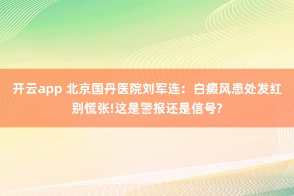 开云app 北京国丹医院刘军连：白癜风患处发红别慌张!这是警报还是信号?